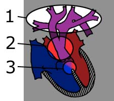 heart2.jpg (17432 bytes)